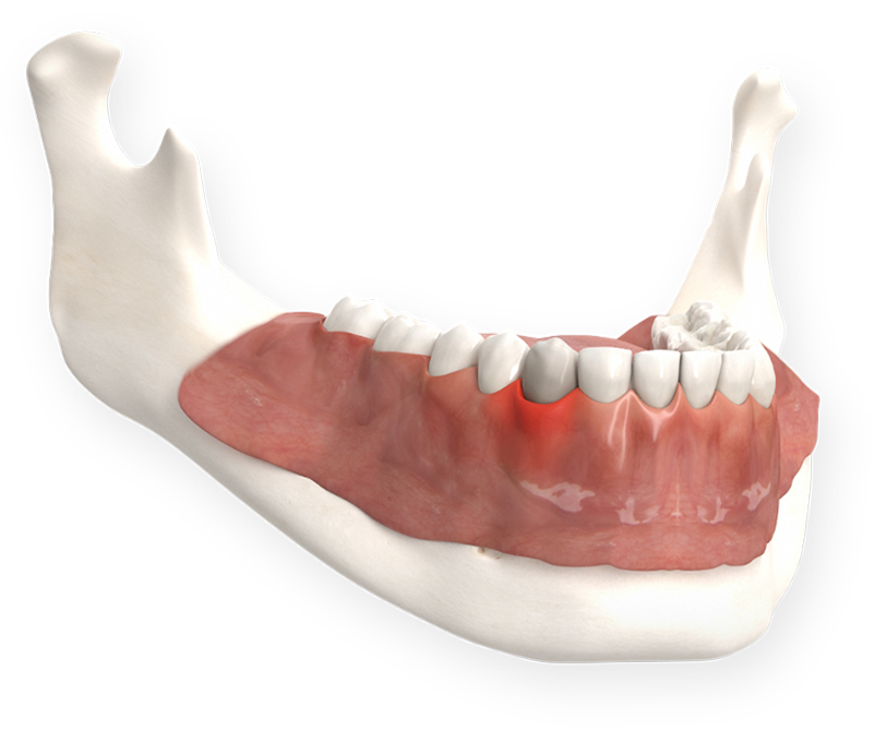 Zahnarzt in Karby & Rieseby für Prophylaxe, Implantate & Co.